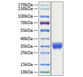 SDS-PAGE - Recombinant Human SLAMF8 Protein (C-terminal His Tag) (A331283) - Antibodies.com