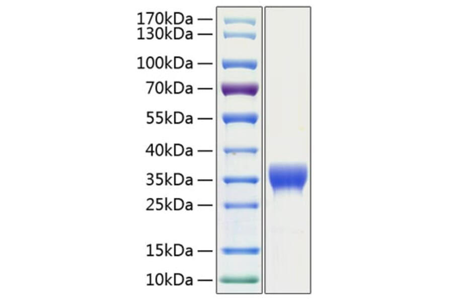 SDS-PAGE - Recombinant Human SLAMF8 Protein (C-terminal His Tag) (A331283) - Antibodies.com