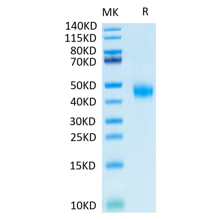 Tris-Bis PAGE - Recombinant Human soluble IL2 Receptor beta Protein (Biotin) (C-terminal His and Avi Tag) (A331285) - Antibodies.com