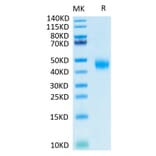 Tris-Bis PAGE - Recombinant Human soluble IL2 Receptor beta Protein (Biotin) (C-terminal His and Avi Tag) (A331285) - Antibodies.com