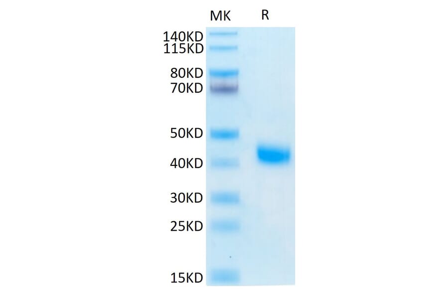 Tris-Bis PAGE - Recombinant Human soluble IL2 Receptor beta Protein (C-terminal His and Avi Tag) (A331286) - Antibodies.com