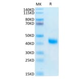 Tris-Bis PAGE - Recombinant Human soluble IL2 Receptor beta Protein (C-terminal His and Avi Tag) (A331286) - Antibodies.com