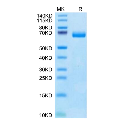 Tris-Bis PAGE - Recombinant Human soluble IL2 Receptor beta Protein (C-terminal Human Fc Tag) (A331287) - Antibodies.com
