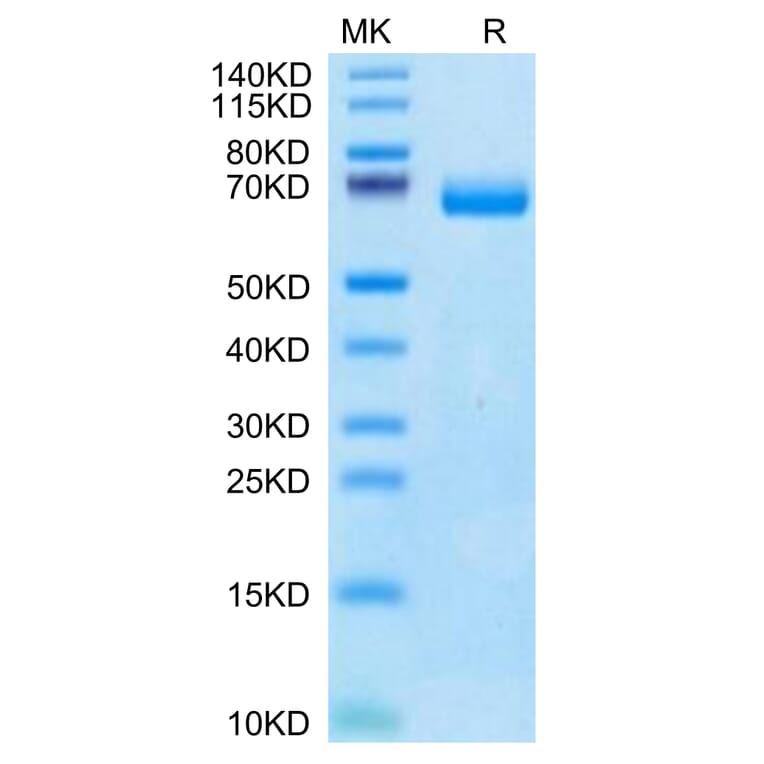 Tris-Bis PAGE - Recombinant Human soluble IL2 Receptor beta Protein (C-terminal Human Fc Tag) (A331287) - Antibodies.com