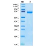 Tris-Bis PAGE - Recombinant Human soluble IL2 Receptor beta Protein (C-terminal Human Fc Tag) (A331287) - Antibodies.com