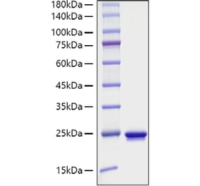 SDS-PAGE - Recombinant Mouse Sonic Hedgehog Protein (C-terminal His Tag) (A331289) - Antibodies.com