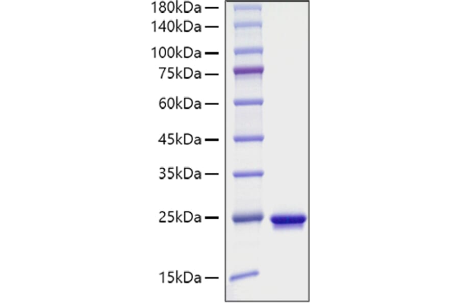 SDS-PAGE - Recombinant Mouse Sonic Hedgehog Protein (C-terminal His Tag) (A331289) - Antibodies.com
