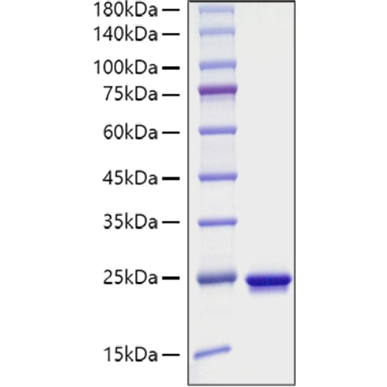 SDS-PAGE - Recombinant Mouse Sonic Hedgehog Protein (C-terminal His Tag) (A331289) - Antibodies.com