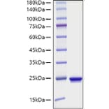 SDS-PAGE - Recombinant Mouse Sonic Hedgehog Protein (C-terminal His Tag) (A331289) - Antibodies.com
