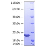 SDS-PAGE - Recombinant Human Sonic Hedgehog Protein (A331290) - Antibodies.com