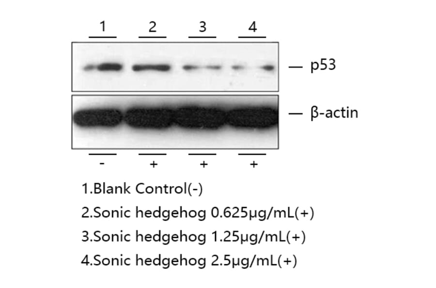 Western Blot - Recombinant Human Sonic Hedgehog Protein (A331290) - Antibodies.com
