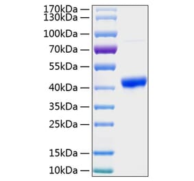 SDS-PAGE - Recombinant Human SPARC Protein (C-terminal His Tag) (A331291) - Antibodies.com