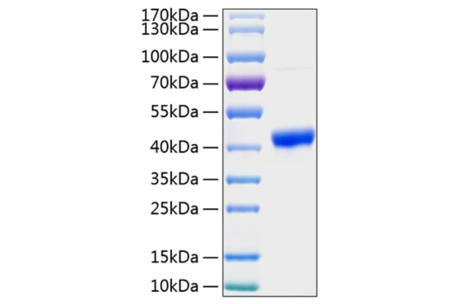 SDS-PAGE - Recombinant Human SPARC Protein (C-terminal His Tag) (A331291) - Antibodies.com