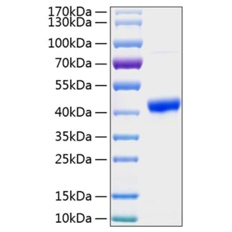 SDS-PAGE - Recombinant Human SPARC Protein (C-terminal His Tag) (A331291) - Antibodies.com