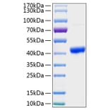 SDS-PAGE - Recombinant Human SPARC Protein (C-terminal His Tag) (A331291) - Antibodies.com