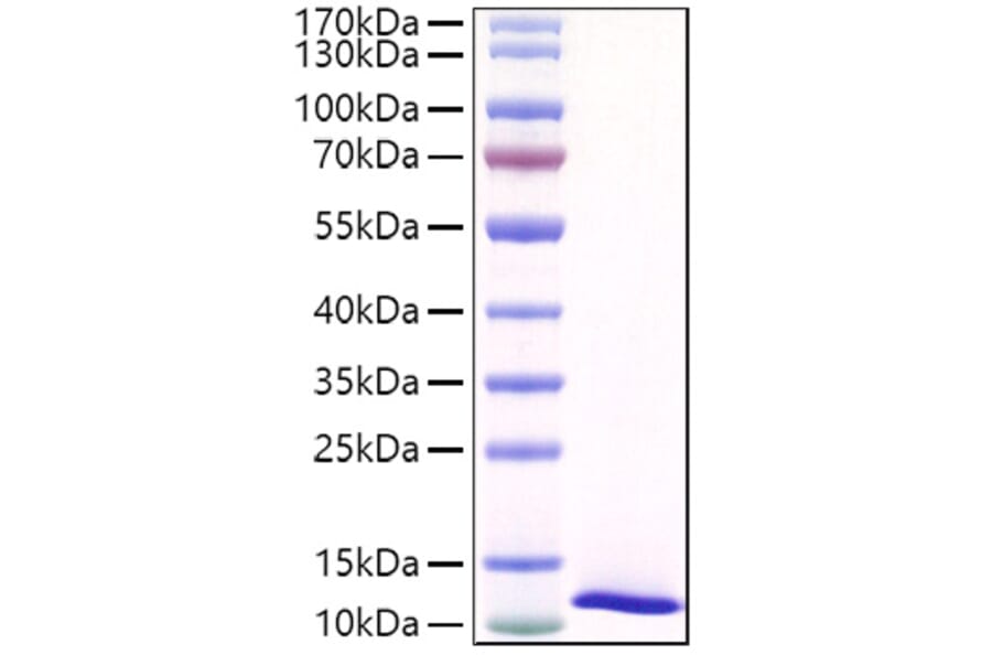 SDS-PAGE - Recombinant Mouse SPINK4 Protein (C-terminal His Tag) (A331292) - Antibodies.com