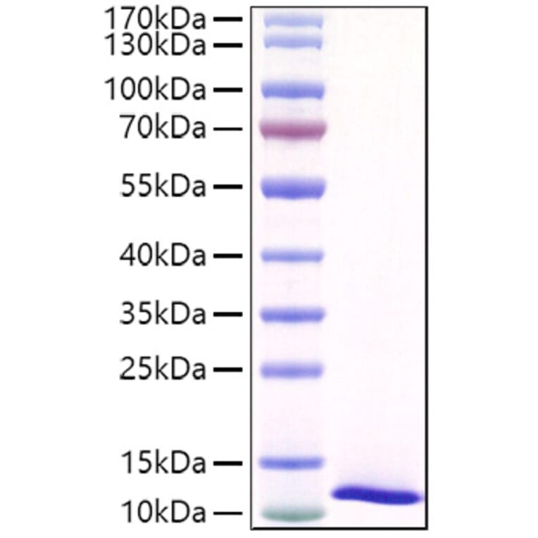 SDS-PAGE - Recombinant Mouse SPINK4 Protein (C-terminal His Tag) (A331292) - Antibodies.com