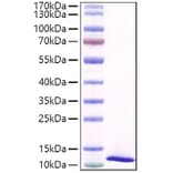 SDS-PAGE - Recombinant Mouse SPINK4 Protein (C-terminal His Tag) (A331292) - Antibodies.com