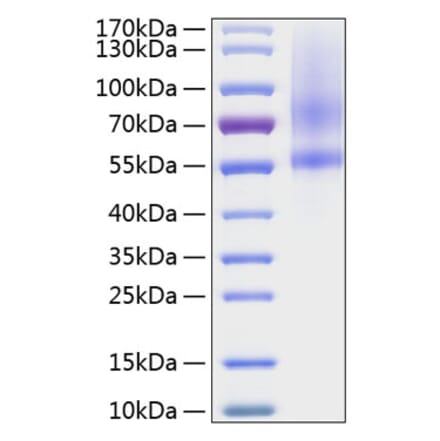SDS-PAGE - Recombinant Human SPOCK1 Protein (C-terminal His Tag) (A331293) - Antibodies.com