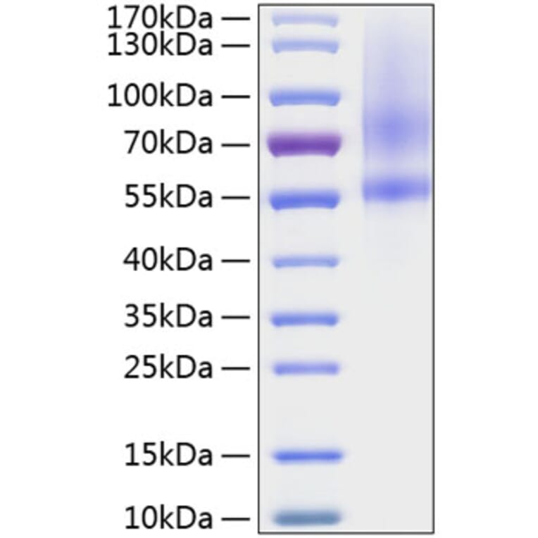 SDS-PAGE - Recombinant Human SPOCK1 Protein (C-terminal His Tag) (A331293) - Antibodies.com