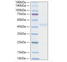 SDS-PAGE - Recombinant Human ST2 Protein (C-terminal His Tag) (A331294) - Antibodies.com
