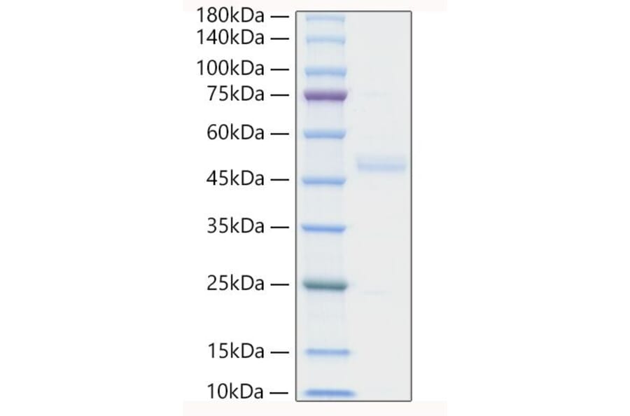SDS-PAGE - Recombinant Human ST2 Protein (C-terminal His Tag) (A331294) - Antibodies.com