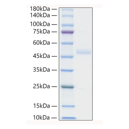 SDS-PAGE - Recombinant Human ST2 Protein (C-terminal His Tag) (A331294) - Antibodies.com