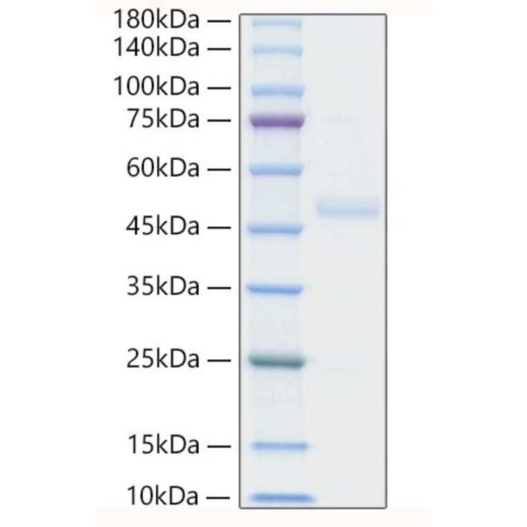 SDS-PAGE - Recombinant Human ST2 Protein (C-terminal His Tag) (A331294) - Antibodies.com