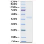 SDS-PAGE - Recombinant Human ST2 Protein (C-terminal His Tag) (A331294) - Antibodies.com