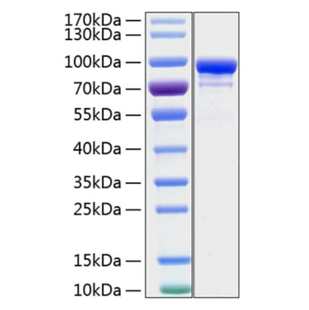 SDS-PAGE - Recombinant Human STAT1 Protein (C-terminal His Tag) (A331295) - Antibodies.com
