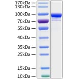 SDS-PAGE - Recombinant Human STAT1 Protein (C-terminal His Tag) (A331295) - Antibodies.com
