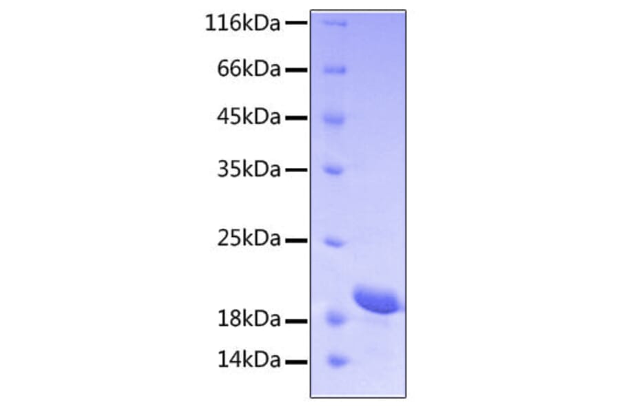 SDS-PAGE - Recombinant Human STAT3 Protein (C-terminal His Tag) (A331296) - Antibodies.com