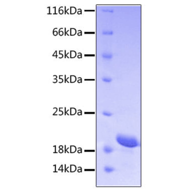 SDS-PAGE - Recombinant Human STAT3 Protein (C-terminal His Tag) (A331296) - Antibodies.com
