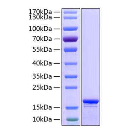 SDS-PAGE - Recombinant Human Stathmin 1 Protein (C-terminal His Tag) (A331297) - Antibodies.com