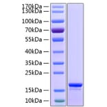 SDS-PAGE - Recombinant Human Stathmin 1 Protein (C-terminal His Tag) (A331297) - Antibodies.com