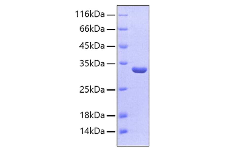 SDS-PAGE - Recombinant Human SULT1A1 Protein (C-terminal His Tag) (A331298) - Antibodies.com