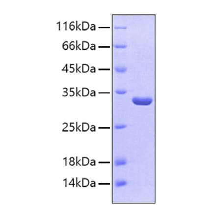 SDS-PAGE - Recombinant Human SULT1A1 Protein (C-terminal His Tag) (A331298) - Antibodies.com