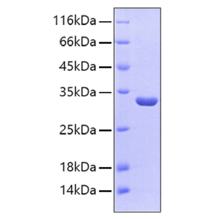 SDS-PAGE - Recombinant Human SULT1A1 Protein (C-terminal His Tag) (A331298) - Antibodies.com