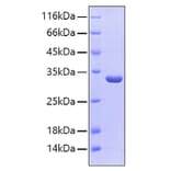 SDS-PAGE - Recombinant Human SULT1A1 Protein (C-terminal His Tag) (A331298) - Antibodies.com