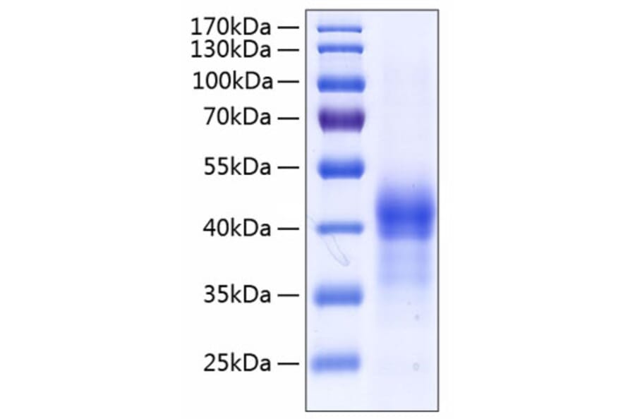SDS-PAGE - Recombinant Human Surfactant Protein D Protein (C-terminal His Tag) (A331300) - Antibodies.com