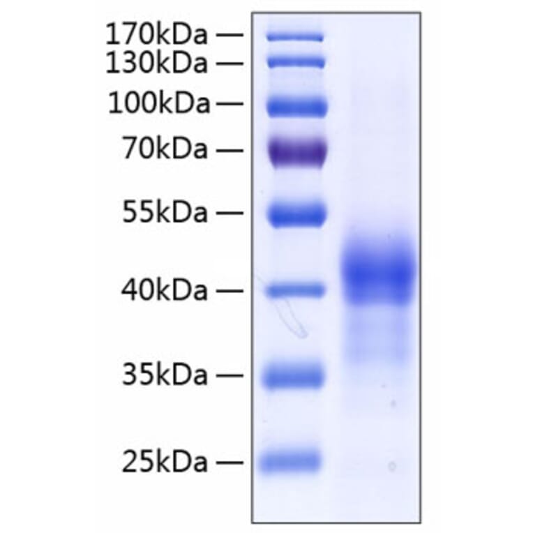 SDS-PAGE - Recombinant Human Surfactant Protein D Protein (C-terminal His Tag) (A331300) - Antibodies.com