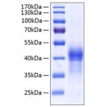 SDS-PAGE - Recombinant Human Surfactant Protein D Protein (C-terminal His Tag) (A331300) - Antibodies.com