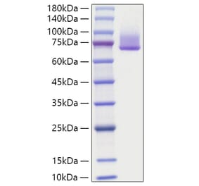 SDS-PAGE - Recombinant Human Syndecan-1 Protein (C-terminal Rabbit Fc Tag) (A331301) - Antibodies.com