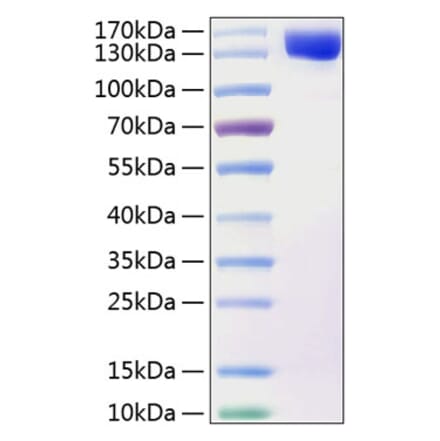 SDS-PAGE - Recombinant Human TAG1 Protein (C-terminal His Tag) (A331302) - Antibodies.com