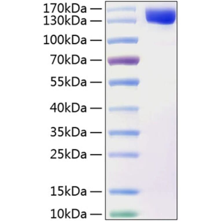 SDS-PAGE - Recombinant Human TAG1 Protein (C-terminal His Tag) (A331302) - Antibodies.com