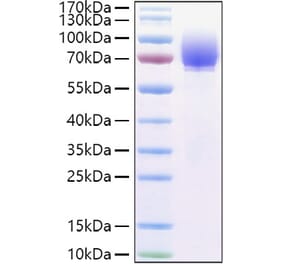 SDS-PAGE - Recombinant Human Tau Protein (C-terminal His Tag) (A331303) - Antibodies.com