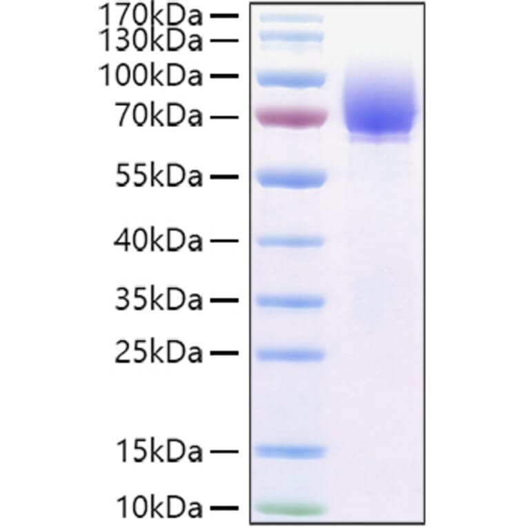 SDS-PAGE - Recombinant Human Tau Protein (C-terminal His Tag) (A331303) - Antibodies.com