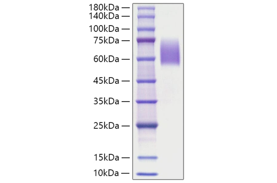 SDS-PAGE - Recombinant Human Tau Protein (C-terminal Human Fc Tag) (A331304) - Antibodies.com