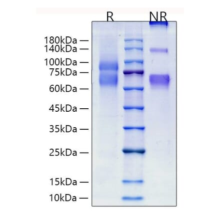 SDS-PAGE - Recombinant Human Tenascin C Protein (C-terminal His Tag) (A331306) - Antibodies.com