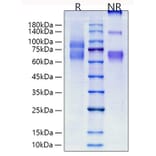 SDS-PAGE - Recombinant Human Tenascin C Protein (C-terminal His Tag) (A331306) - Antibodies.com
